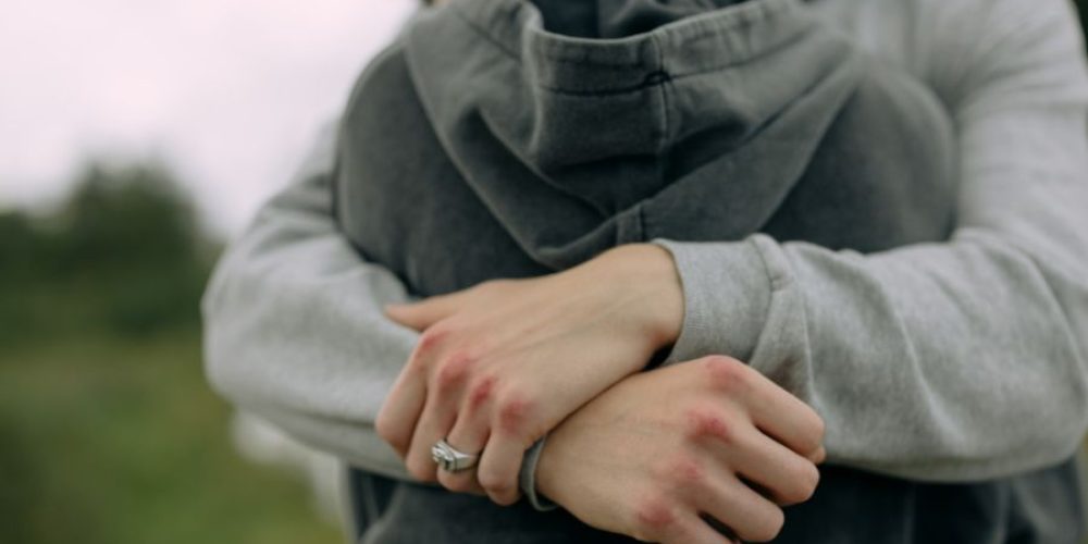 The Power of a Hug On Our Health